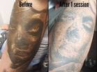 Новое фотографию  Лазерное удаление татуировок и перманентного макияжа 38546153 в Красноярске
