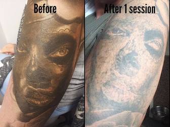 Новое фотографию  Лазерное удаление татуировок и перманентного макияжа 38546153 в Красноярске