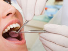 Скачать бесплатно изображение Медицинские услуги Акция в стоматологии на чистку зубов 39227026 в Москве